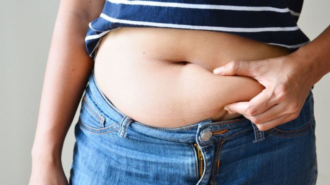 Nutukimas JK sukelia daugiau kai kurių vėžių atvejų nei rūkymas