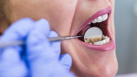 Dar vienas leiboristų pažadas – „nemokama dantų techninė apžiūra“