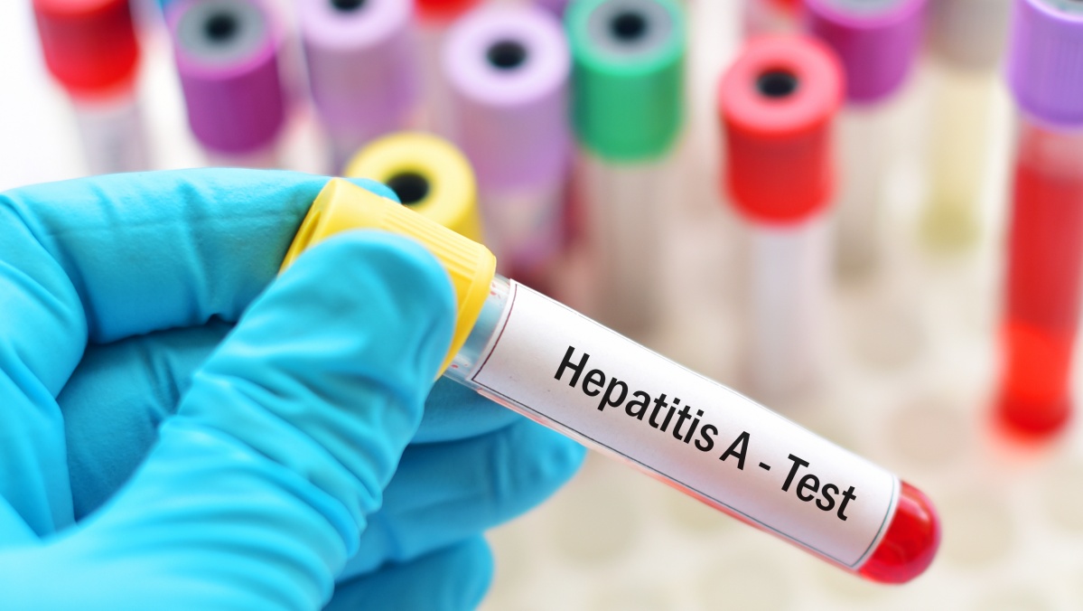 Hepatito protrūkis tarp vaikų: vienas jau mirė, 17-ai prireikė kepenų persodinimo