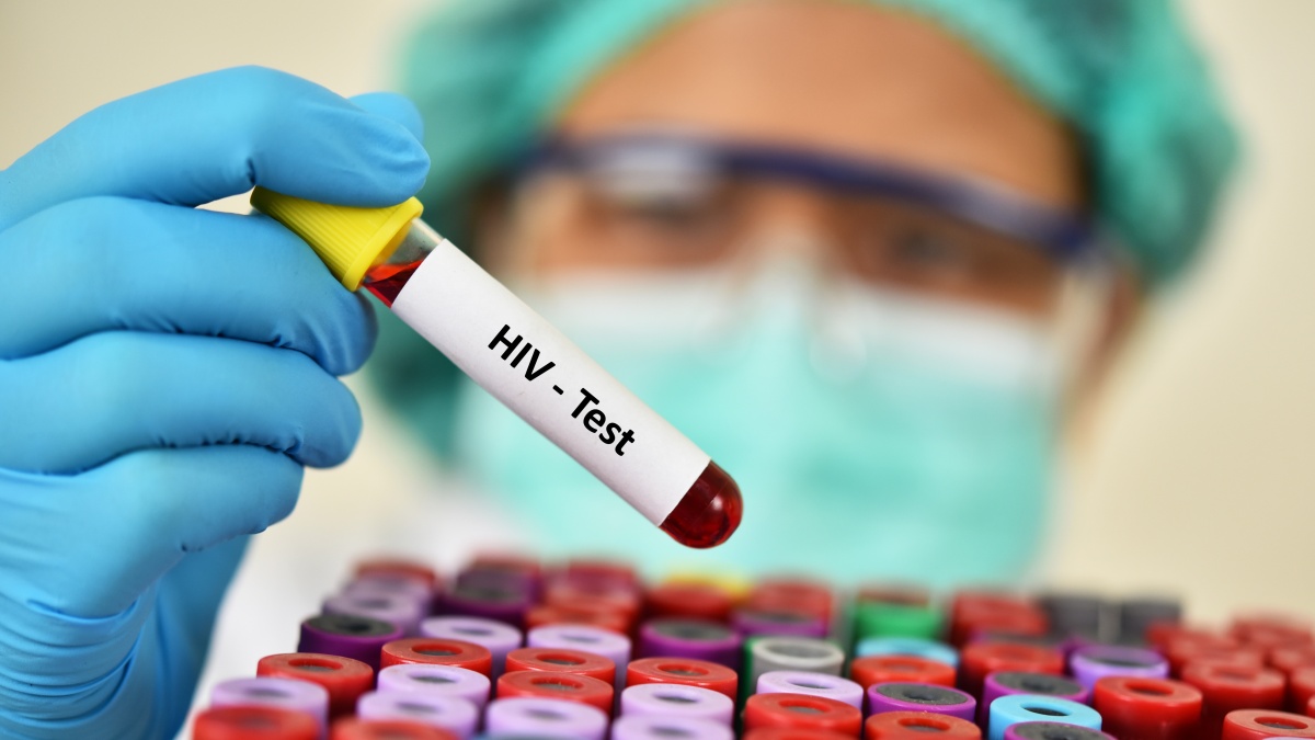 Anglijos gyventojams bus siūloma nemokamų namudinių ŽIV testų