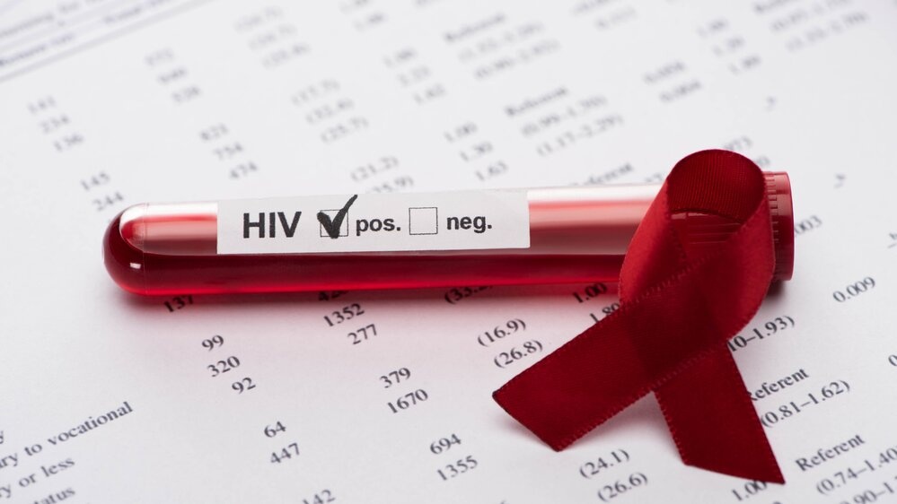 Londonas pirmasis pasaulyje nebeturės naujų ŽIV atvejų