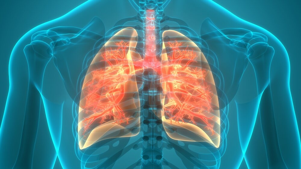 Londone – pavojaus ženklai dėl smarkiai išaugusių užsikrėtimų tuberkulioze