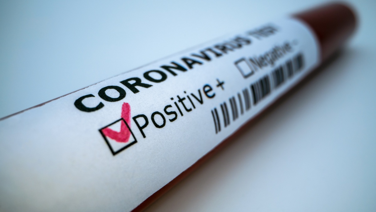 Koronavirusas vėl kelia galvą Jungtinėje Karalystėje