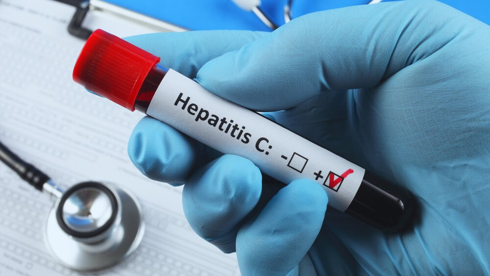 Užkrėsto kraujo skandalas JK: žmonės masiškai perka hepatito C testus