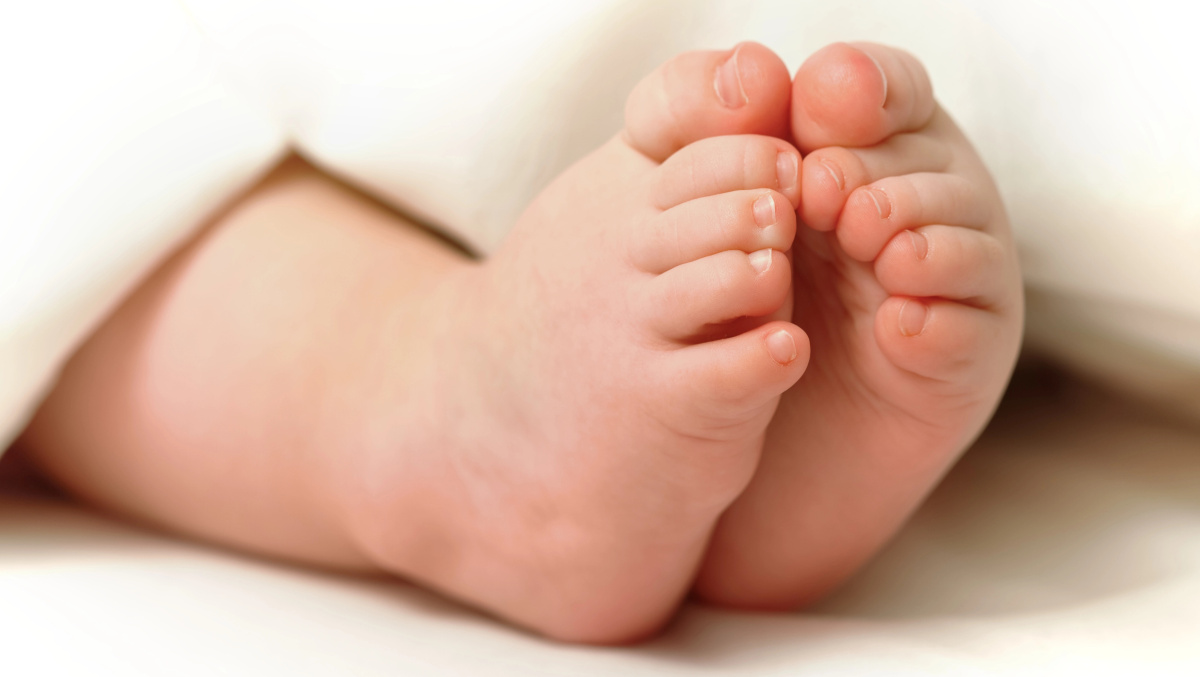 Škotai pirmieji JK tirs naujagimius dėl retos genetinės ligos