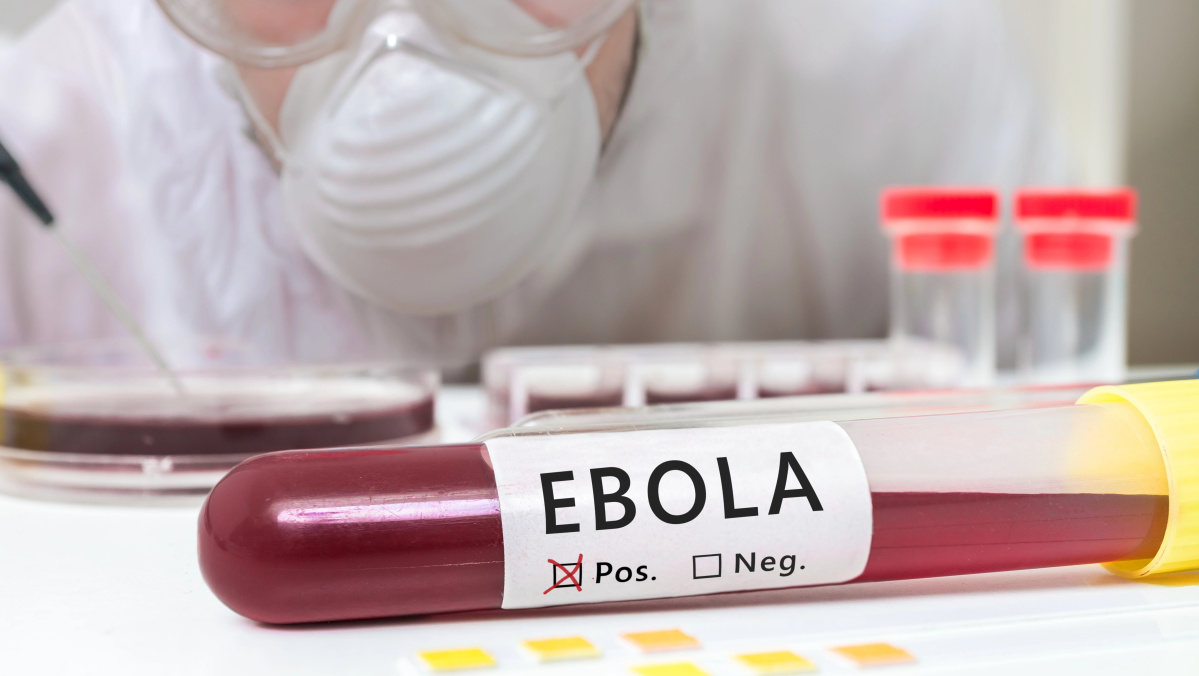 JK pradedami vos per aštuonias savaites sukurtos Ebolos vakcinos bandymai