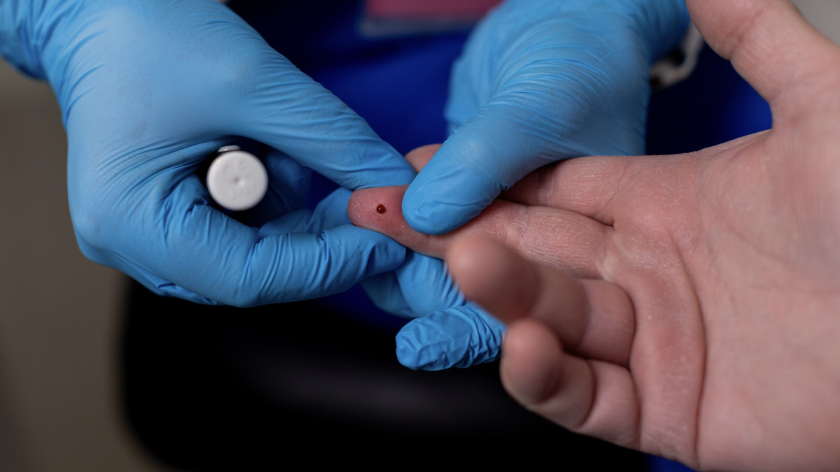 Anglijos vaistinėse NHS siūlys nemokamus cholesterolio tyrimus